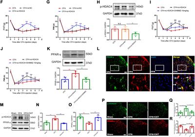 Catalpol ameliorates CFA-induced inflammatory pain by targeting spinal cord and peripheral inflammation